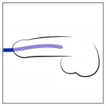 You2Toys Dilator - szilikon húgycsőtágító dilátor szett (3 db)